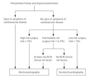 Diagram of electrocardiogram