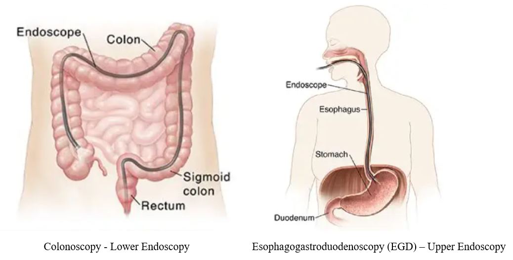 Endoscopy Services Tomah Health